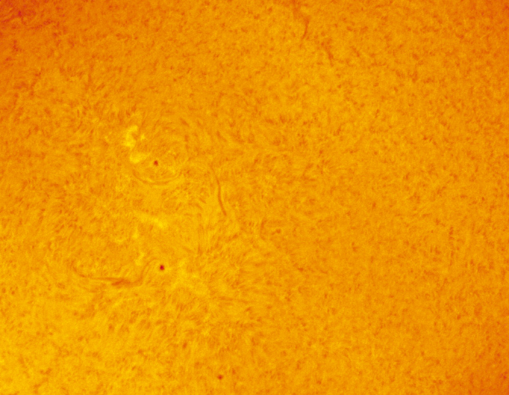 The Sun!