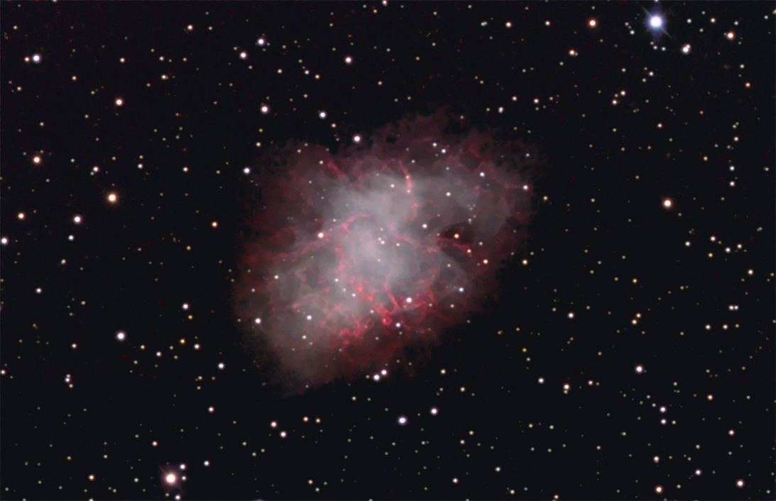 M1