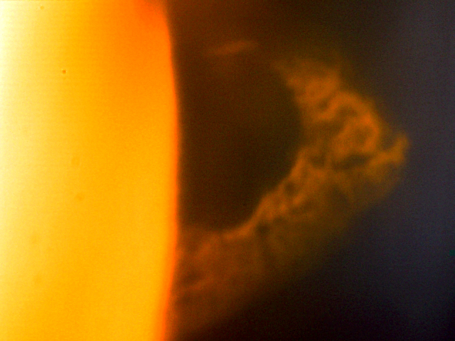 Solar Prominence